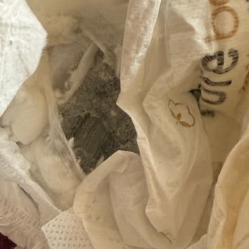 Bebek Bezinde Sakıza Benzer Yabancı Madde Şoku!