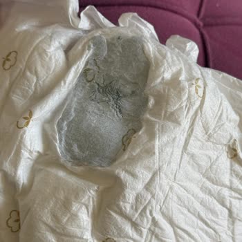 Bebek Bezinde Sakıza Benzer Yabancı Madde Şoku!