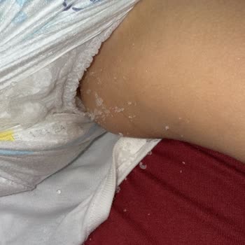 Molfix Bebek Bezinden Kristal Parçalar Dökülmesi Endişesi