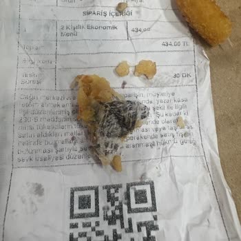 Siparişimden Çıkan Yabancı Maddeye İlgisiz Yaklaşım