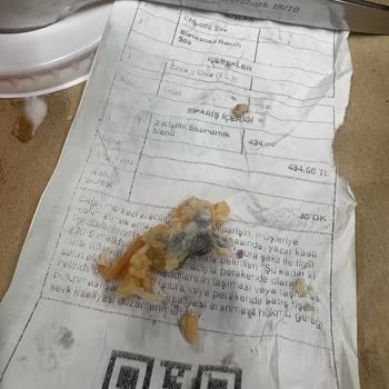 Siparişimden Çıkan Yabancı Maddeye İlgisiz Yaklaşım