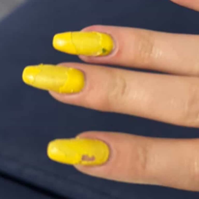 Protez Tırnakta Hayal Kırıklığı Ve İlgisizlik