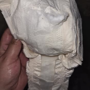 Defolu Bebek Bezleri Nedeniyle Maddi Ve Manevi Mağduriyet