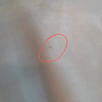 Aldığım Takım Elbisede Leke Çıktı Değişim Talebim Var