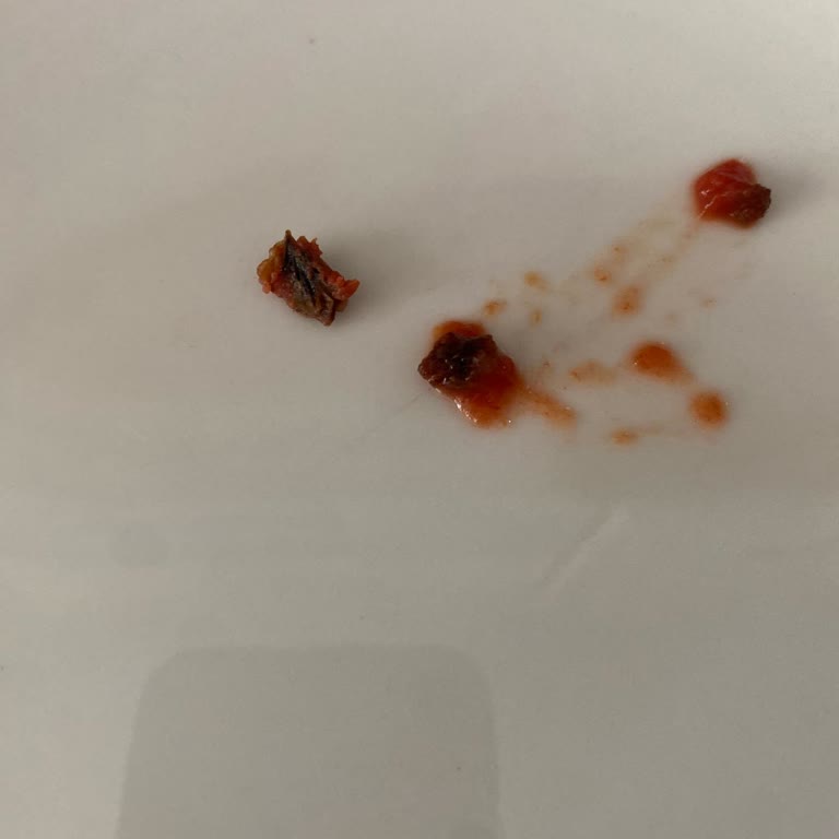 Tukaş Domates Püresinde Yabancı Madde Şüphesi Ve Hayal Kırıklığı