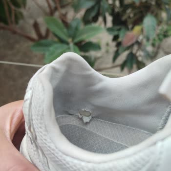 Skechers Ayakkabıda Erken Deformasyon Ve Olumsuz Müşteri Hizmeti Deneyimi