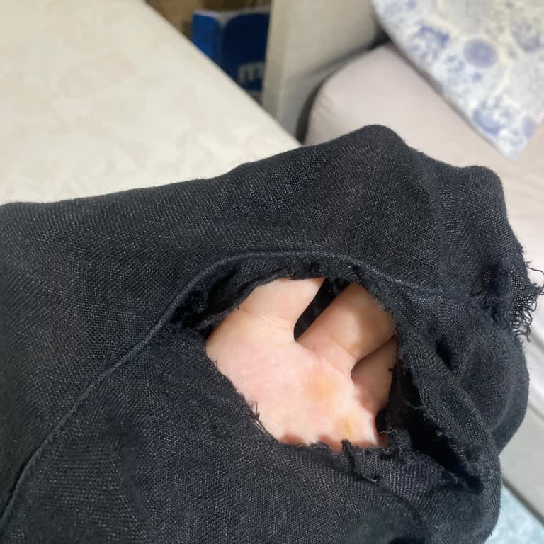 Üçüncü Giyimde Yırtılan Pantolon İçin İade Ya Da Değişim Talebi