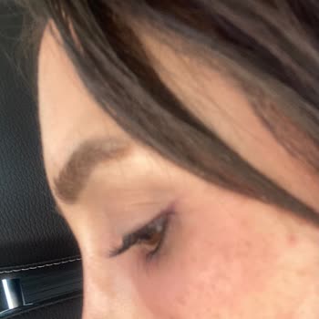 Yves Rocher Göz Altı Ürünü Cildimde Alerjik Reaksiyona Neden Oldu