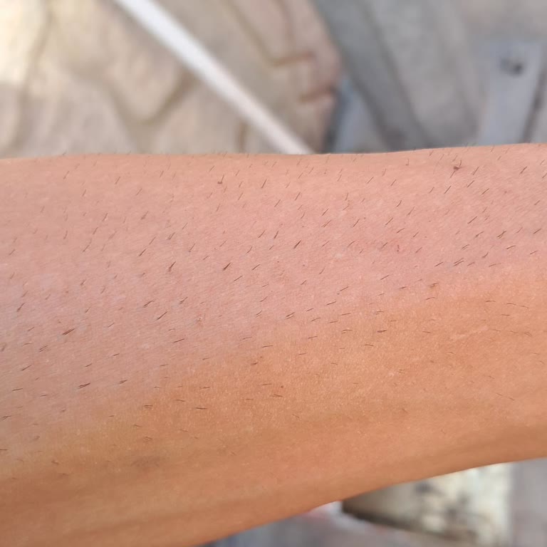 Kullanılan Ürünün Kısa Sürede Etkisiz Olması Ve Cilt Sorunu