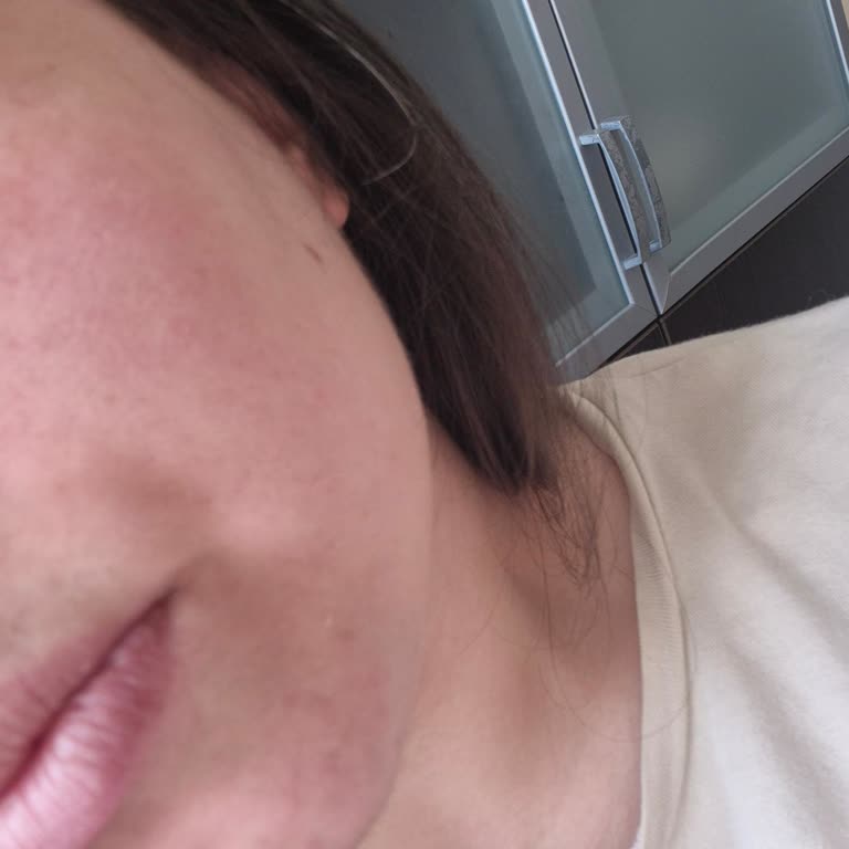 Yüz Yıkama Jelinin Ciltte Kızarıklık Ve Yanma Yapması Hayal Kırıklığı Yarattı