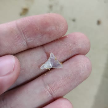 Pizzadan Çıkan Sert Plastik Dişime Zarar Verdi