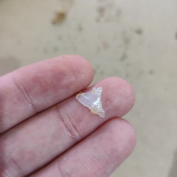 Pizzadan Çıkan Sert Plastik Dişime Zarar Verdi