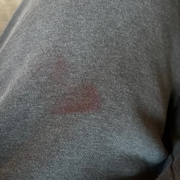 Çanta Boyasının Akması ve Müşteri Hizmeti Sorunu