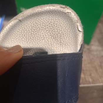 Satın Alınan Sandaletin İlk Giyimde Ciddi Şekilde Deforme Olması