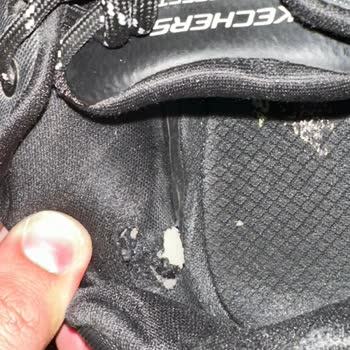 6 Ayda Yıpranan Skechers Ayakkabım İçin Değişim Talebim Reddedildi
