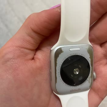 Apple Watch SE Saatimde Hızla Artan Aşınma Ve Renk Değişimi Sorunu