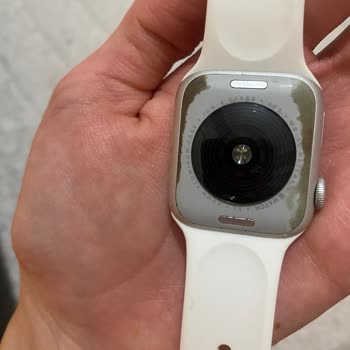 Apple Watch SE Saatimde Hızla Artan Aşınma Ve Renk Değişimi Sorunu