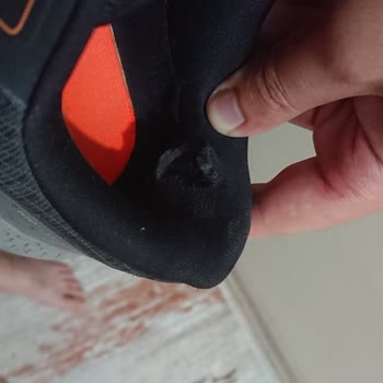 6 Ayda Yırtılan Skechers Ayakkabı