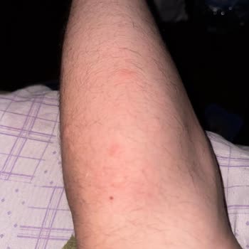 Raid Elektro Likit Sinek Kovucu Hiçbir Etki Göstermedi