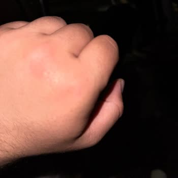 Raid Elektro Likit Sinek Kovucu Hiçbir Etki Göstermedi