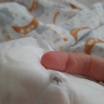Wee Baby Göğüs Pedi Küflü Ve Dayanıksız Çıktı