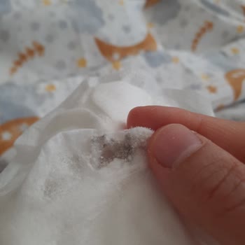Wee Baby Göğüs Pedi Küflü Ve Dayanıksız Çıktı
