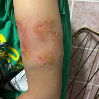 At Saldırısında Yetersiz Müdahale Ve İşletme İhmali