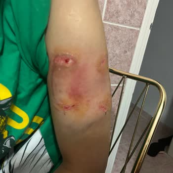 At Saldırısında Yetersiz Müdahale Ve İşletme İhmali