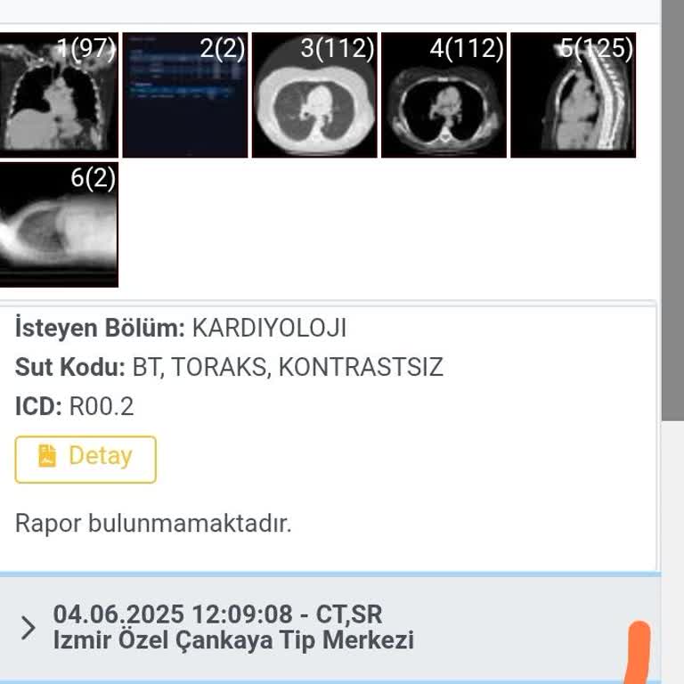 Kardiyoloji Dışında İlgisiz Ve Baştan Savma Hizmet
