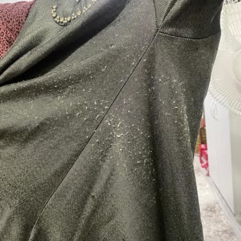 Bayramda Giydiğim Elbise İlk Kullanımda Tüylenme Yaptı