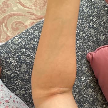 Ameliyat Sonrası Hatalı Sonuç Ve İlgisizlik Mağduriyeti