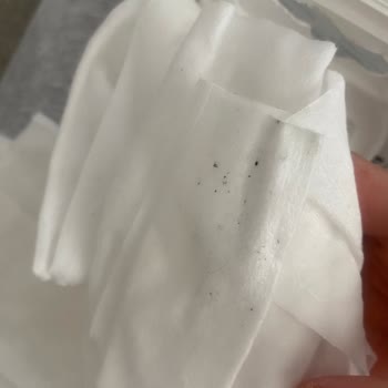 Bebek Islak Mendilinde Küf Şoku: Sağlık Endişesi Yaşıyorum