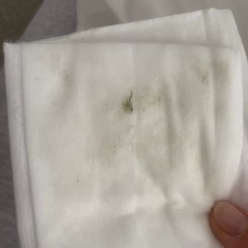 Bebek Islak Mendilinde Küf Şoku: Sağlık Endişesi Yaşıyorum