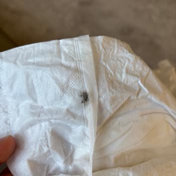 Bebek Bezinden Böcek Çıktı, Müşteriyle Dalga Geçiliyor