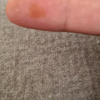 Test Kiti Kullanımı Sonrası Sağlık Sorunları Ve Yetersiz Bilgilendirme