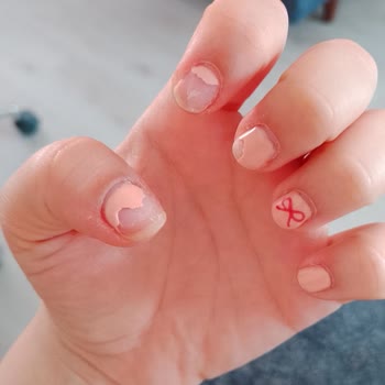 Kalıcı Oje Sonrası Tırnaklarda Hasar Ve İletişim Sorunu