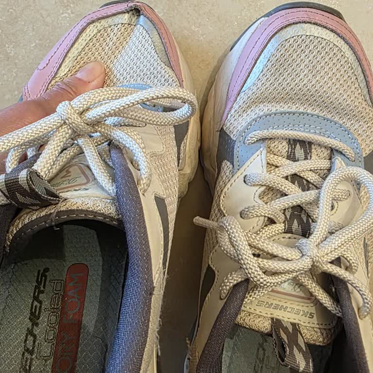 Skechers Ayakkabım Bir Yılda Açıldı Sorumluluk Bana Yıkıldı