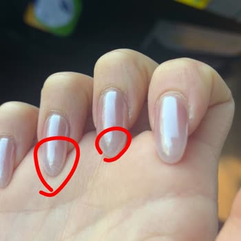 Tırnak Bakımında İlgisizlik Ve Kalitesiz Hizmet