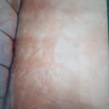 Teslimatta Hasarlı Koltuk Ve İade Talebinin Karşılanmaması