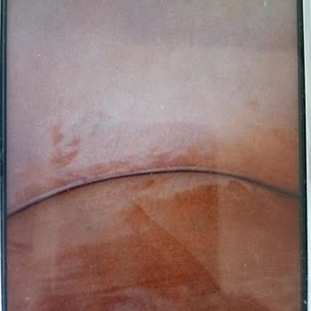 Teslimatta Hasarlı Koltuk Ve İade Talebinin Karşılanmaması