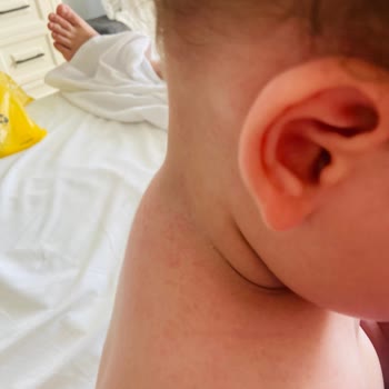 Rox Resort Hotel Müşteri Memnuniyetsizliği