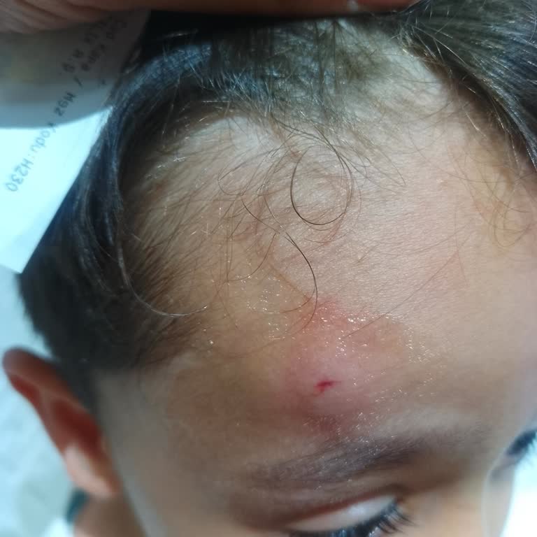 Mağazada Güvenlik Ve Düzen Eksikliği Nedeniyle Yaşanan Kaza