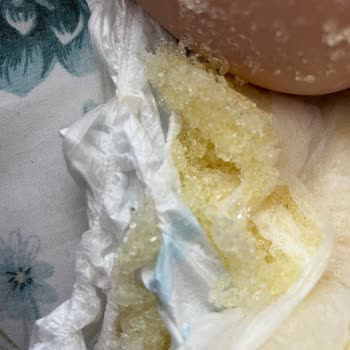 Molfix 5 Numara Bezinde Parçalanma Ve Sızıntı Sorunu, Mağduriyet Yaşadım!