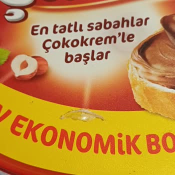 Satın Alınan Üründe Yabancı Madde Çıkması Nedeniyle Güvenlik Endişesi