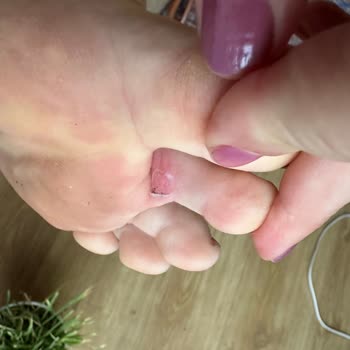 Aldığım Pahalı Ayakkabı Ayağımı Yaraladı, Memnun Kalmadım