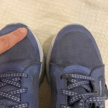 Aldığım Skechers Ayakkabı Kısa Sürede Bozuldu, İade Talebim Reddedildi