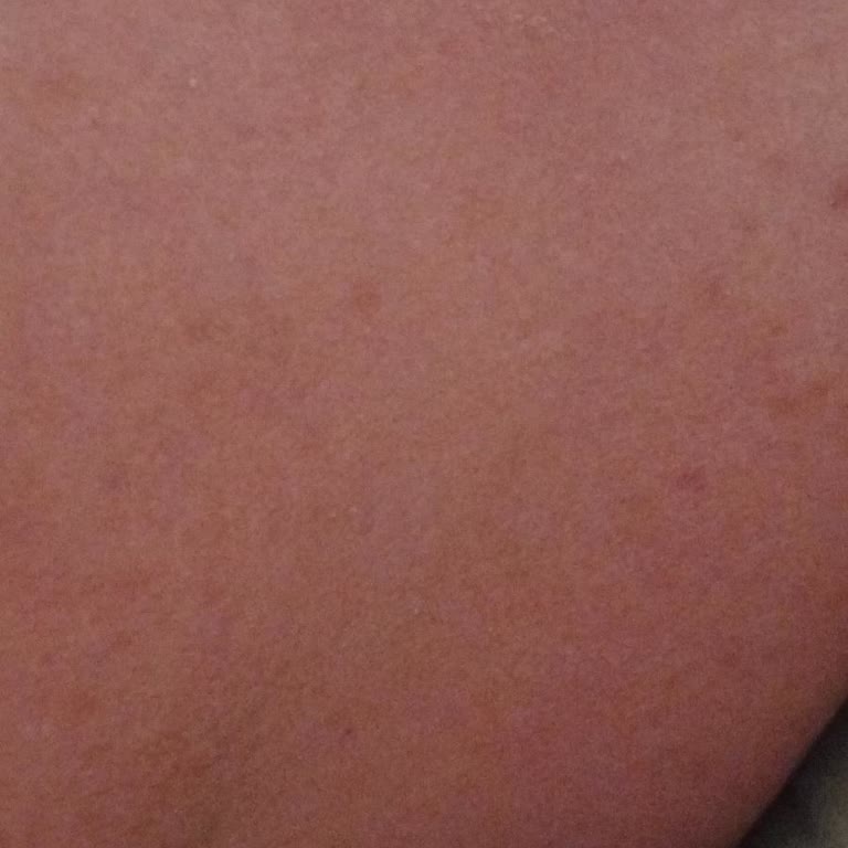 Dear Body Güneş Kremi Kullanımı Sonrası Ciltte Yanma Ve Acı Sorunu!