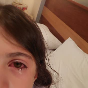 Tatilbudur Tatilde Mikrop Kaptık Hijyensiz Odalar Kötü Yemekler Ve İade Alamadık!