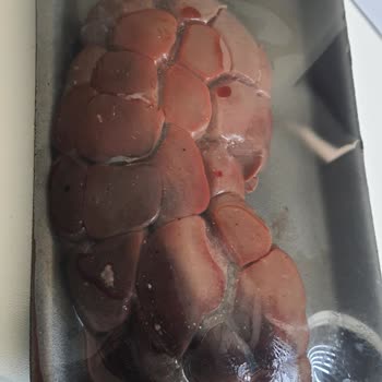 Carrefourdan Alınan Kurban Hissesinde Bozuk Ciğer Ve Eksik Organ Sorunu