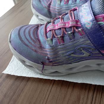 Az Kullanılan Skechers Ayakkabıda Erken Deformasyon Ve Sonuçsuz Destek